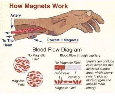Magnetic_Therapy